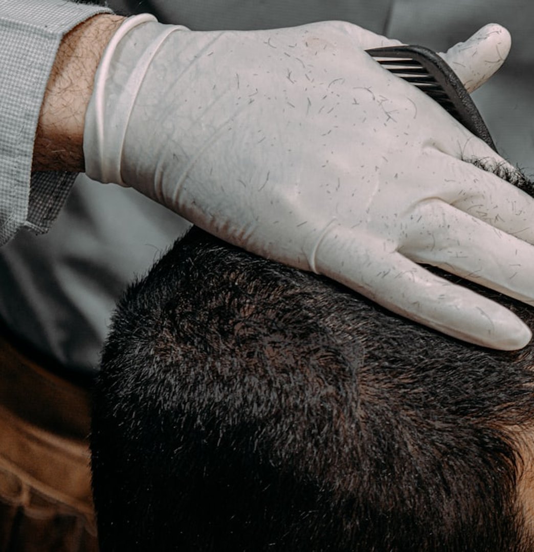 Close-up of a scalp hair restoration assessment
