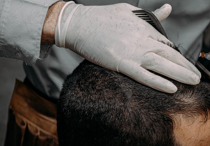 Close-up of a scalp hair restoration assessment